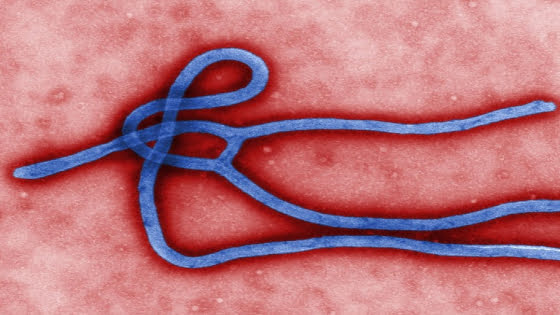 فيروس أيبولا